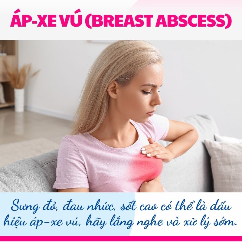 Áp-xe vú: Cách xử lý nhanh chóng và phòng ngừa biến chứng nguy hiểm