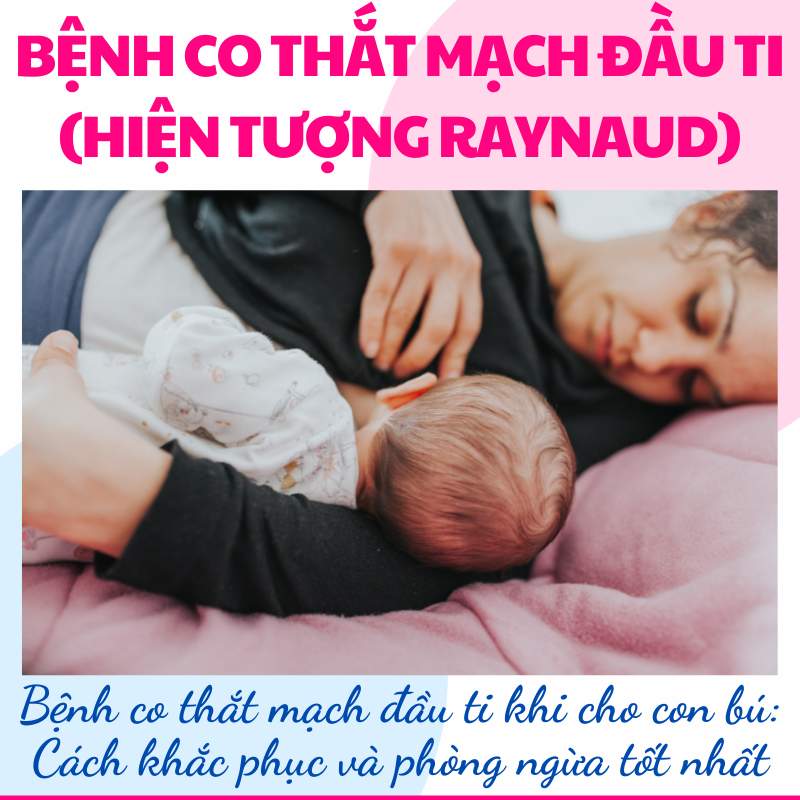 Bệnh co thắt đầu ti