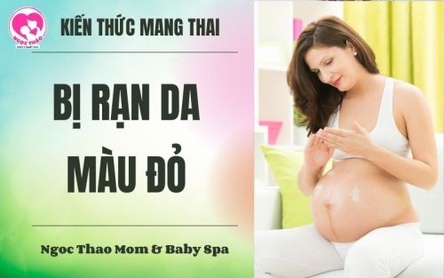bị rạn da màu đỏ