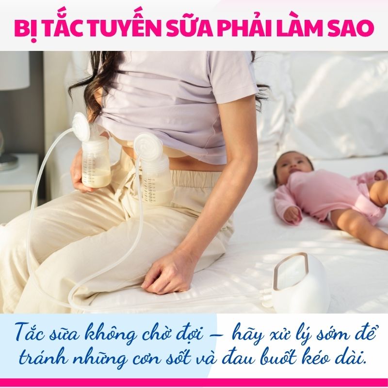 Tắc sữa không chờ đợi – hãy xử lý sớm để tránh những cơn sốt và đau buốt kéo dài.