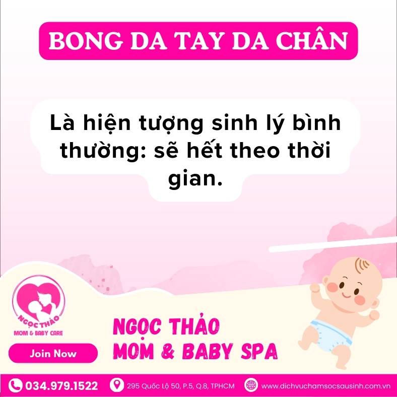 Bong da tay da chân ở trẻ sơ sinh