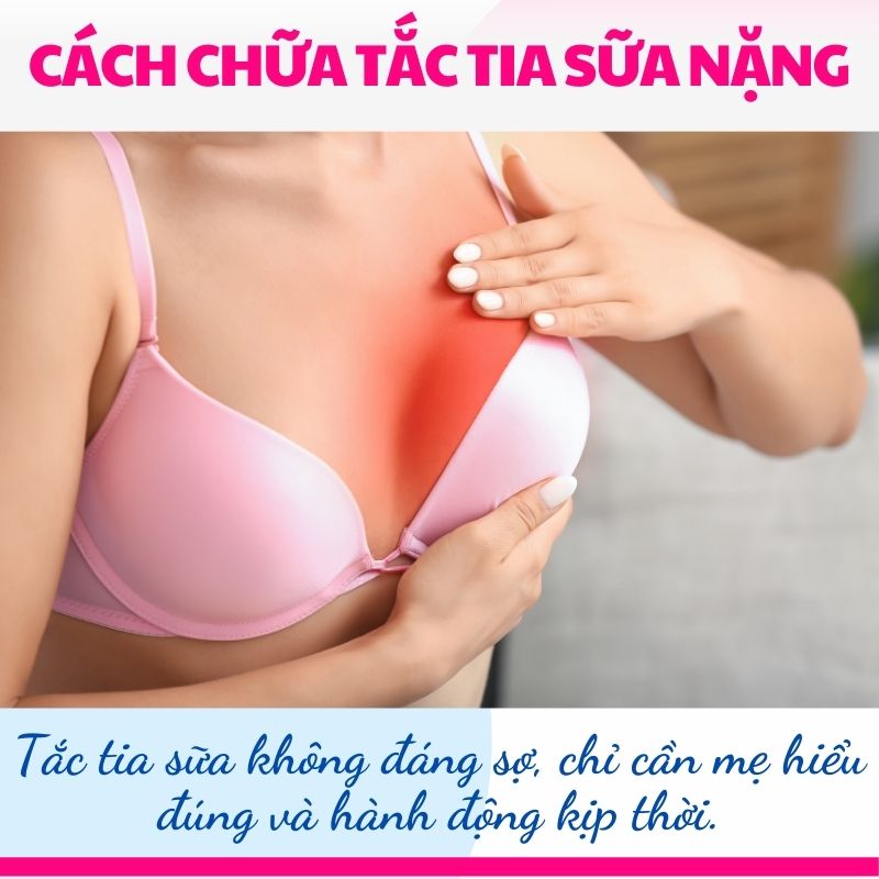 Tắc tia sữa không đáng sợ, chỉ cần mẹ hiểu đúng và hành động kịp thời.