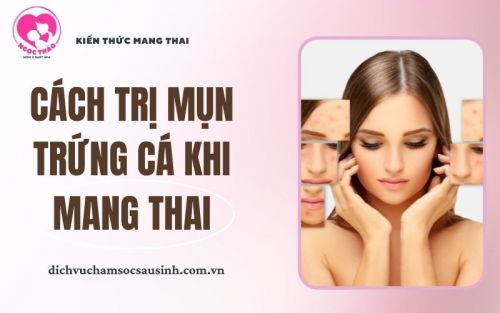 Mụn trứng cá khi mang thai