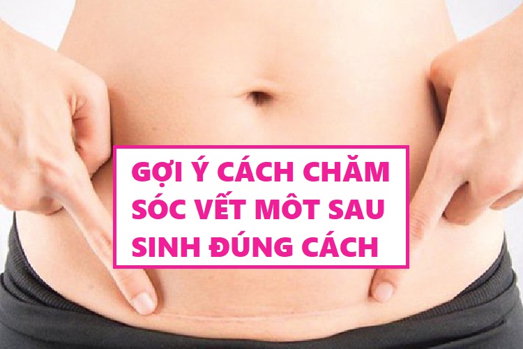 Chăm sóc vết mổ sau sinh tránh nhiễm trùng, ngừa sẹo, nhanh hồi phục