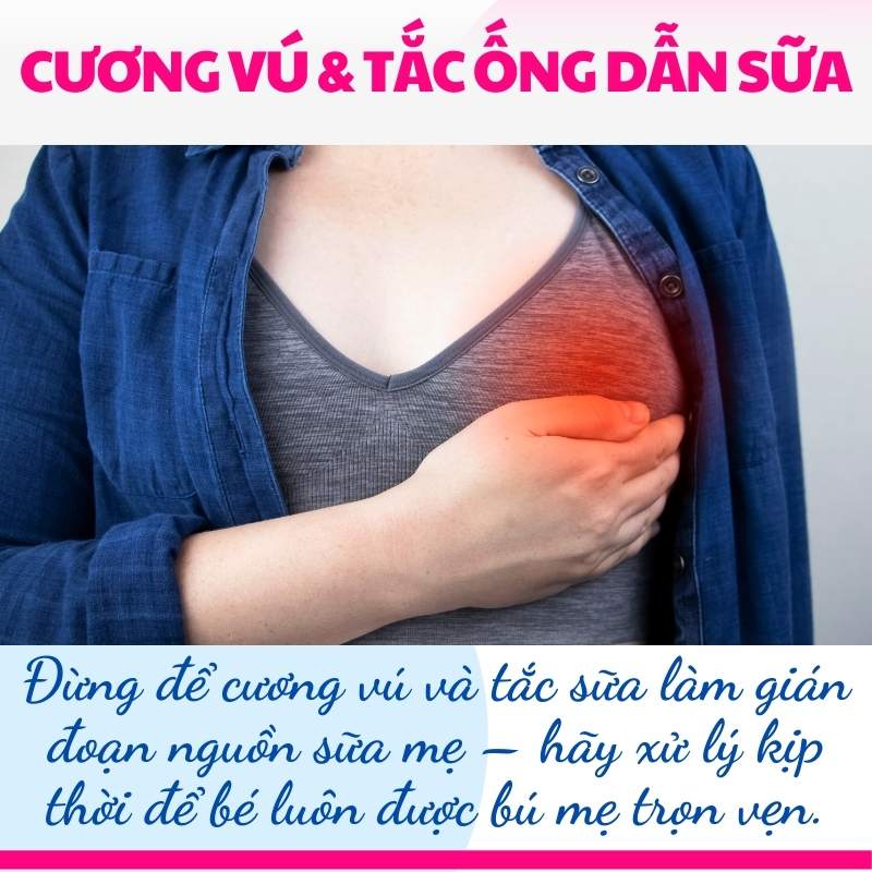 Cương sữa và tắc ống dẫn sữa