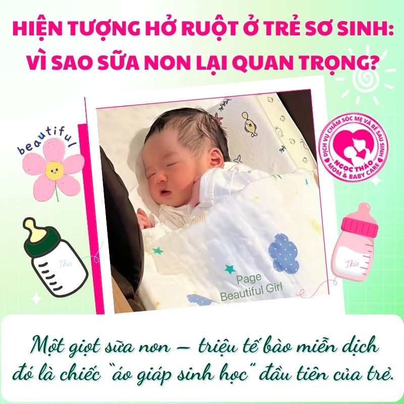 Sữa mẹ và hệ tiêu hoá trẻ sơ sinh: Bí quyết ngăn ngừa hiện tượng hở ruột