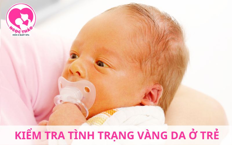 Kiểm tra tình trạng vàng da ở trẻ sơ sinh