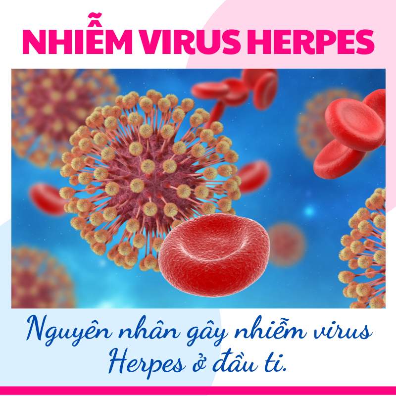 nguyên nhân mẹ bị nhiễm virus herpes ở đầu ti