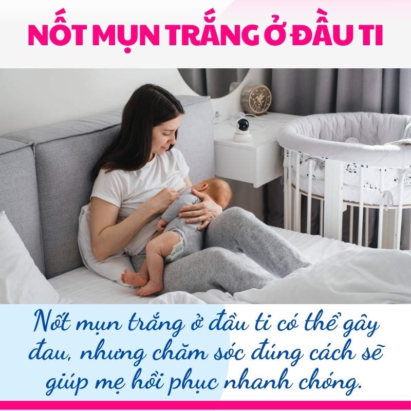 Nốt mụn trắng ở đầu ti cà cách chăm sóc