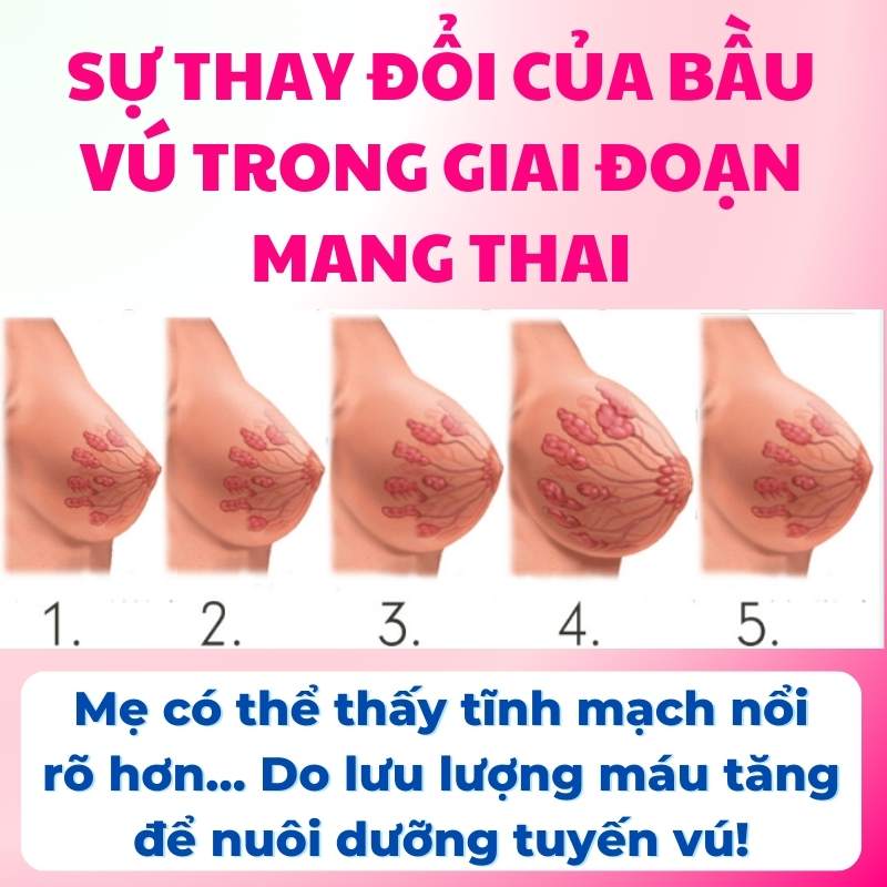 Khi mang thai, bầu vú lớn hơn…Để chuẩn bị cho hành trình nuôi con bằng sữa mẹ!