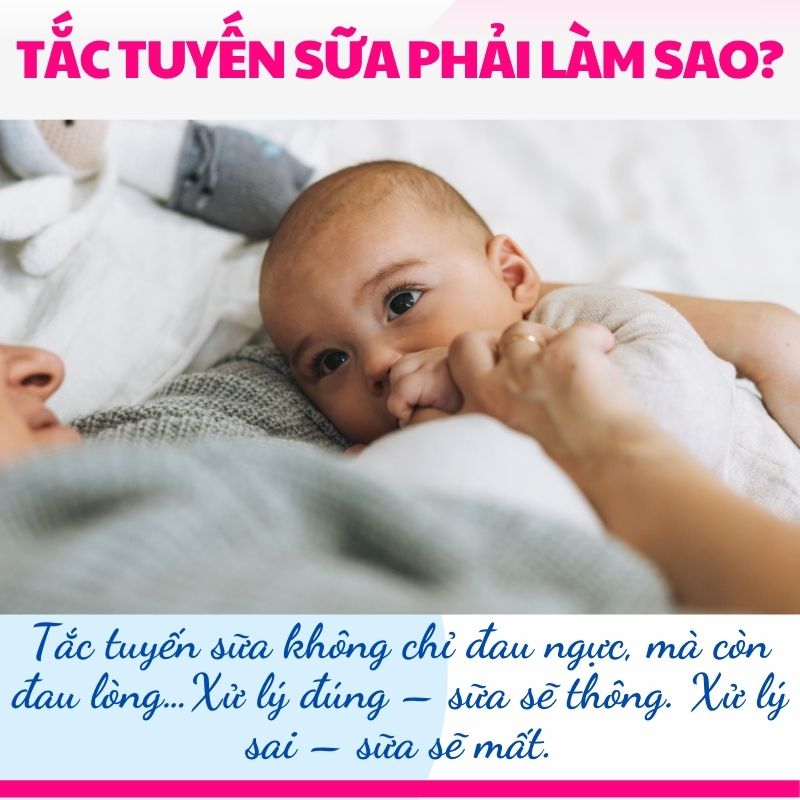 Tắc tuyến sữa không chỉ đau ngực, mà còn đau lòng…Xử lý đúng – sữa sẽ thông. Xử lý sai – sữa sẽ mất.