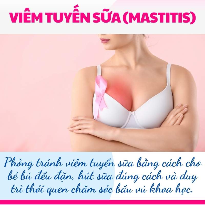 Viêm tuyến sữa khi cho con bú là tình trạng thường gặp ở mẹ sau sinh